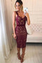 Sexy Sheath Knee Length Homecoming Dresses, Straps Lace Short Prom Dresses UQ1810